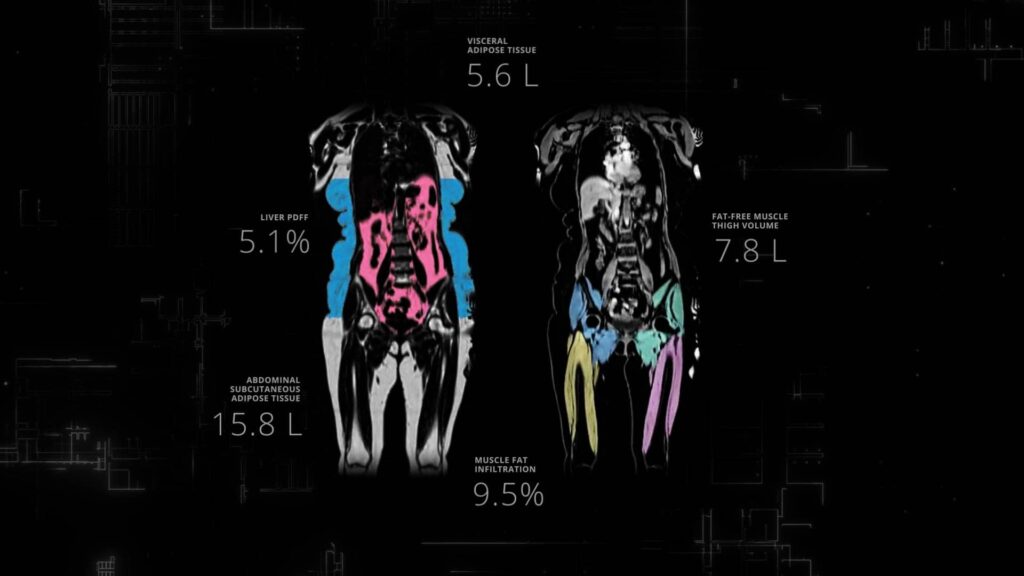 Scan with biomarkers - Dataset Expansion