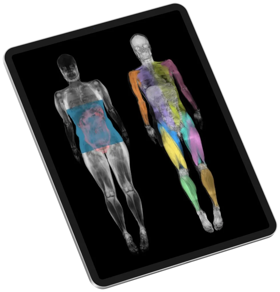 How to Read a DEXA Scan? - AQ Imaging Network