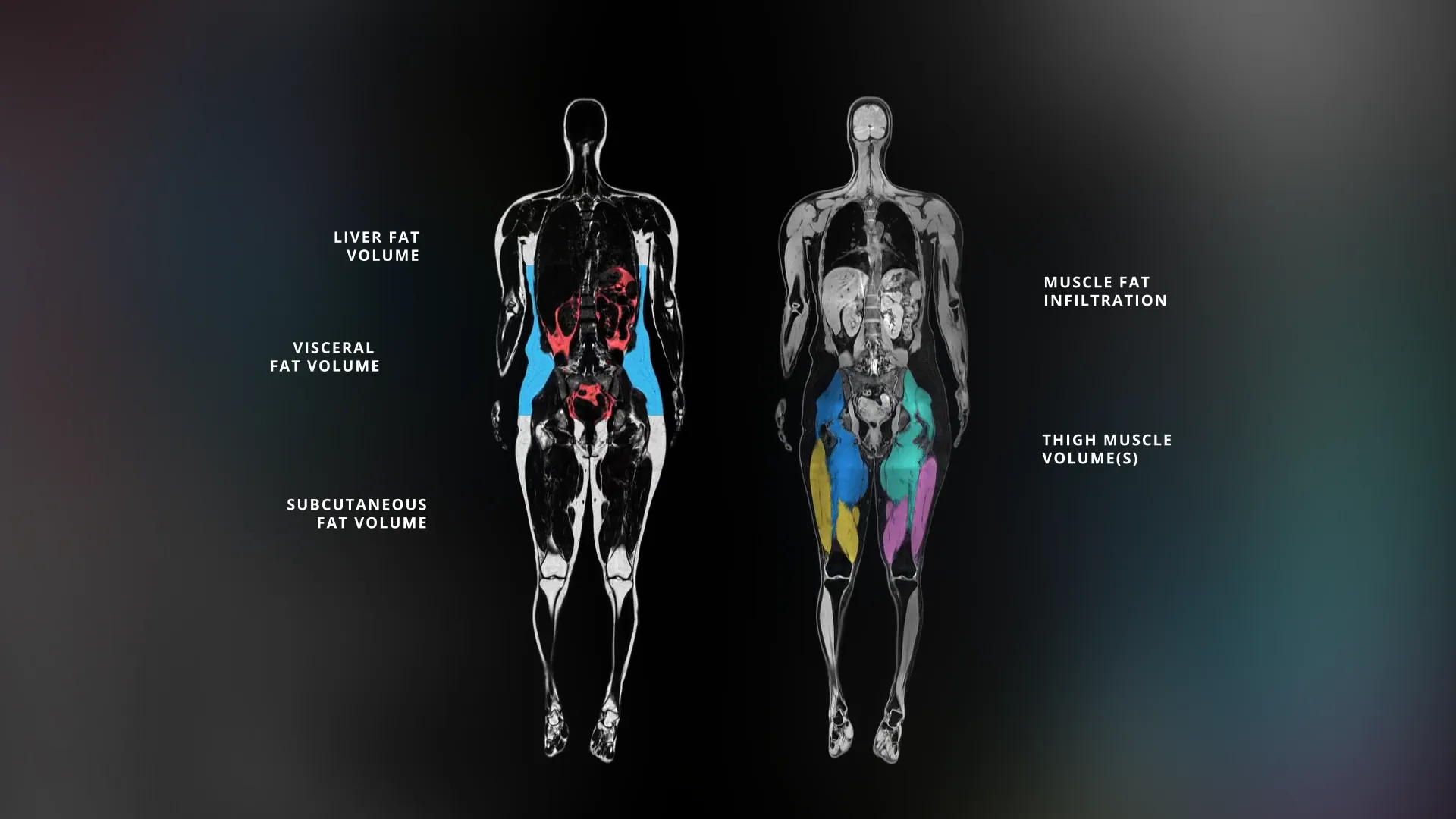 Body Composition - Health Insights